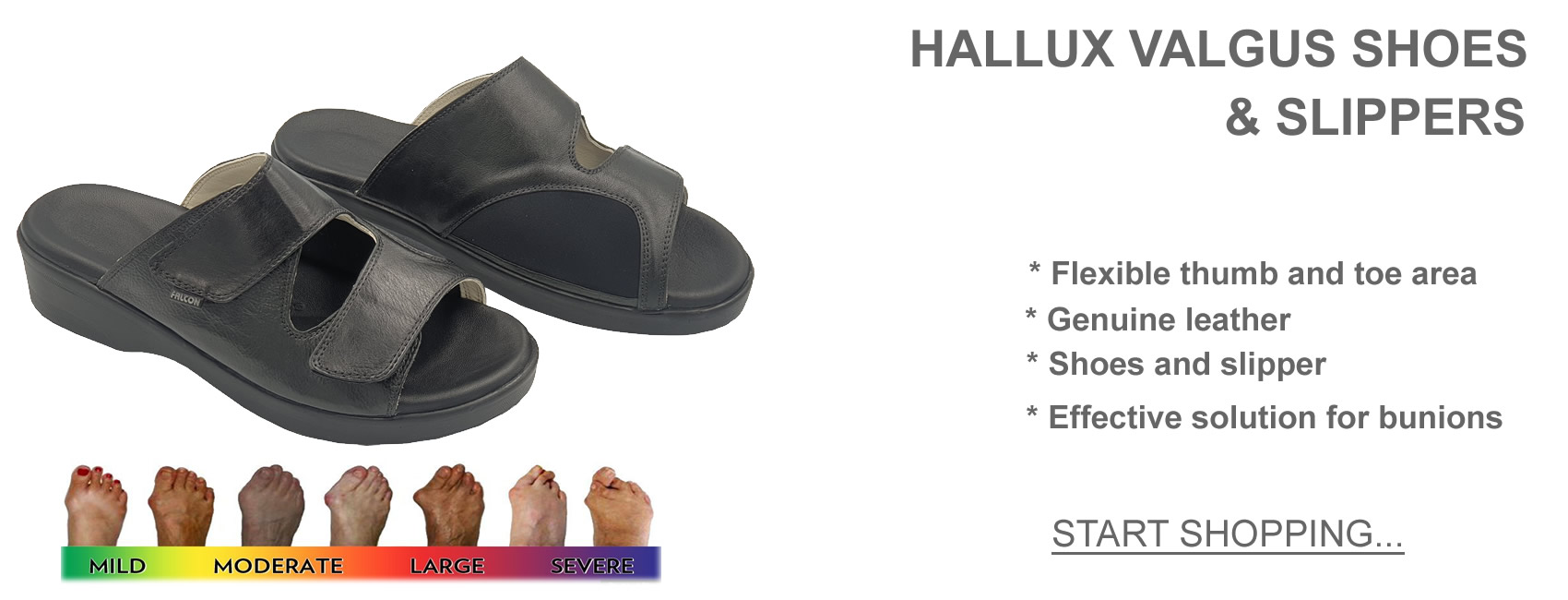 Hallux Valgu